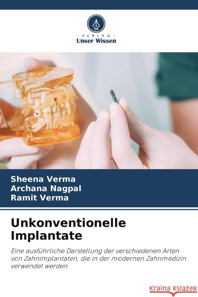 Unkonventionelle Implantate Verma, Sheena, Nagpal, Archana, verma, Ramit 9786205557778