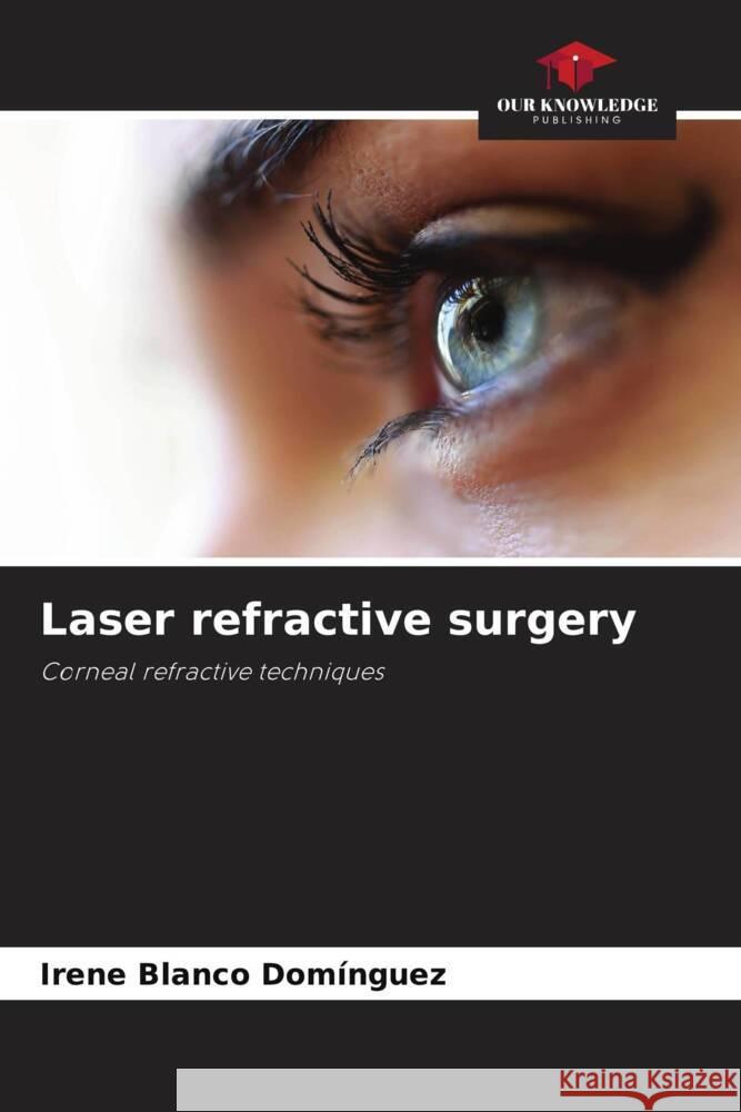 Laser refractive surgery Blanco Domínguez, Irene 9786205558621 Our Knowledge Publishing