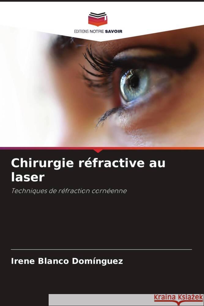 Chirurgie réfractive au laser Blanco Domínguez, Irene 9786205558638