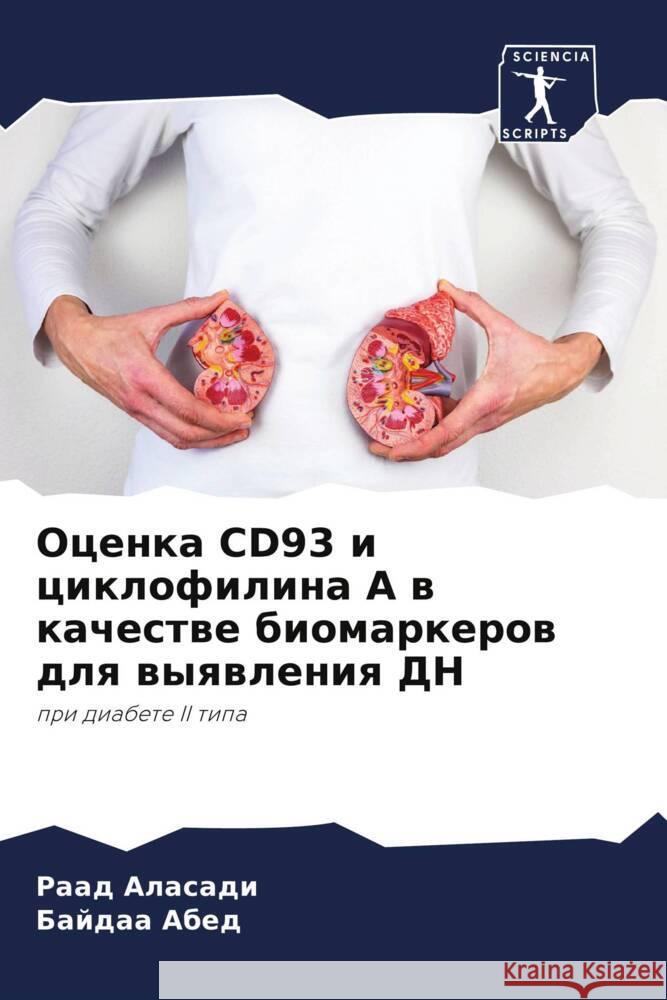 Ocenka CD93 i ciklofilina A w kachestwe biomarkerow dlq wyqwleniq DN Alasadi, Raad, Abed, Bajdaa 9786205565063 Sciencia Scripts