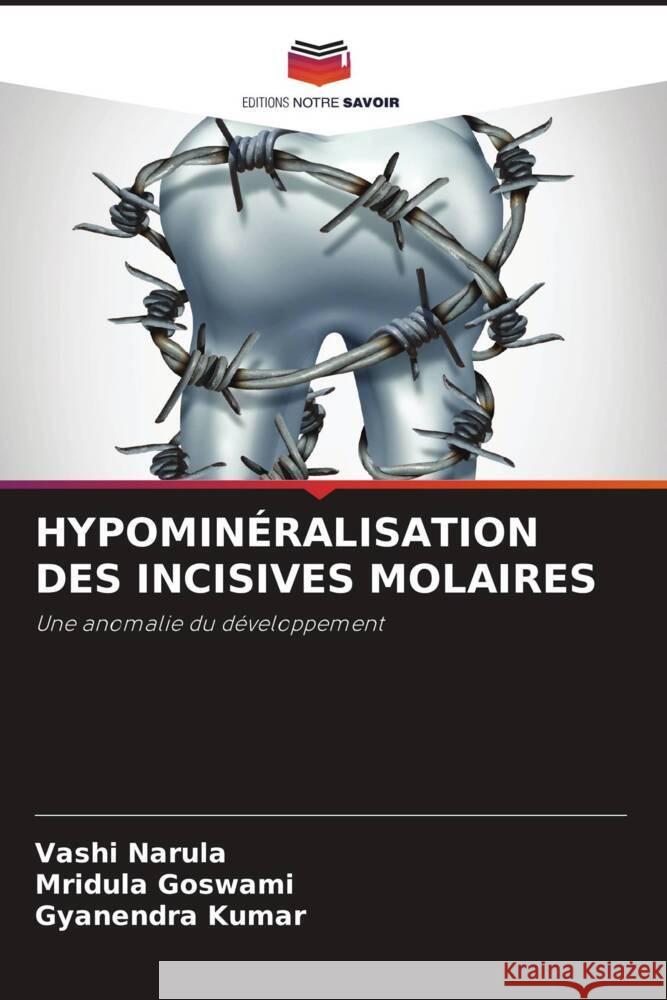 HYPOMINÉRALISATION DES INCISIVES MOLAIRES Narula, Vashi, Goswami, Mridula, Kumar, Gyanendra 9786205567128