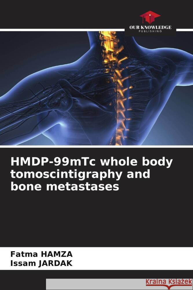 HMDP-99mTc whole body tomoscintigraphy and bone metastases HAMZA, Fatma, JARDAK, Issam 9786205569351