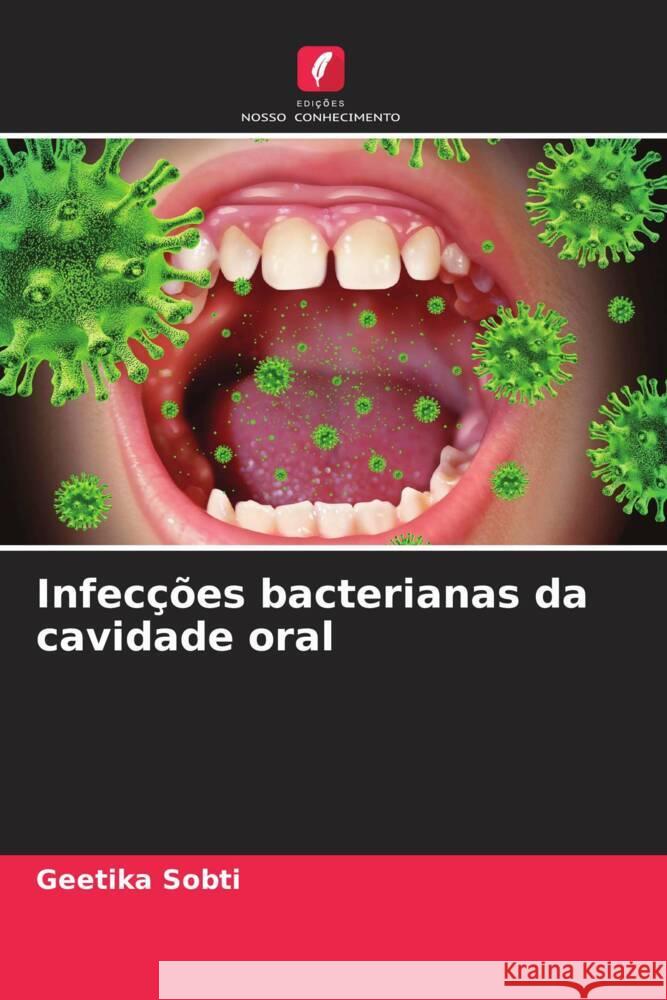 Infecções bacterianas da cavidade oral Sobti, Geetika 9786205572450