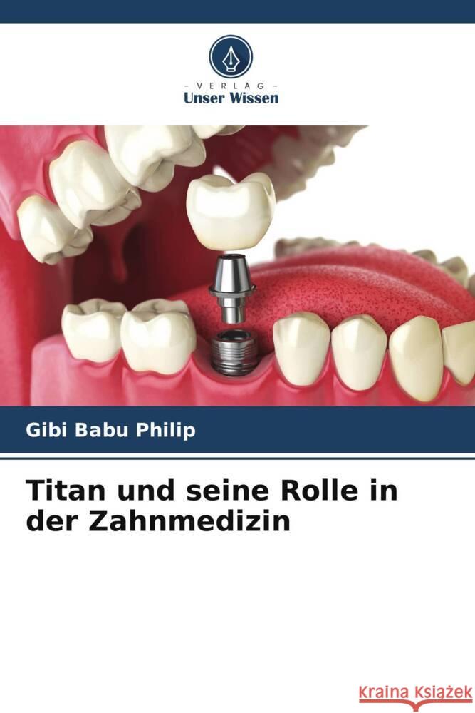 Titan und seine Rolle in der Zahnmedizin Philip, Gibi Babu 9786205572672