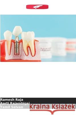 Impacto do pilar de implante nas propriedades ?pticas das coroas de zirc?nia Ramesh Raja Aarti Rajambigai Tamil Selvan 9786205576748 Edicoes Nosso Conhecimento