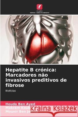 Hepatite B cr?nica: Marcadores n?o invasivos preditivos de fibrose Houda Be Makram Koubaa Mounir Be 9786205582671 Edicoes Nosso Conhecimento