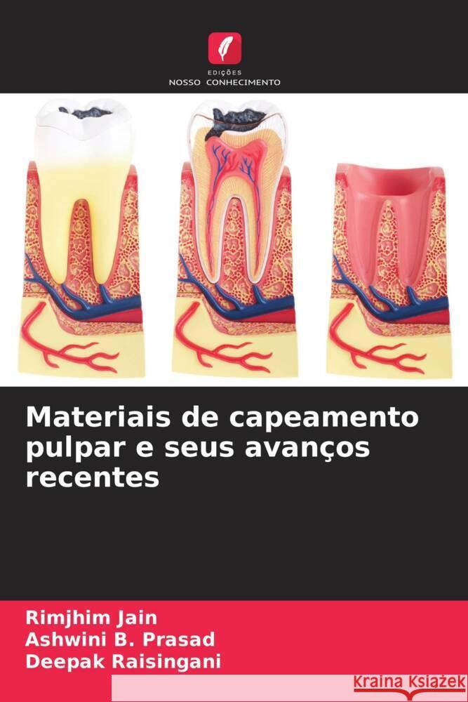 Materiais de capeamento pulpar e seus avanços recentes Jain, Rimjhim, B. Prasad, Ashwini, Raisingani, Deepak 9786205594384 Edições Nosso Conhecimento