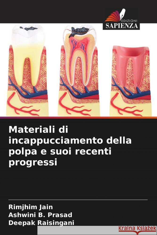 Materiali di incappucciamento della polpa e suoi recenti progressi Jain, Rimjhim, B. Prasad, Ashwini, Raisingani, Deepak 9786205594445