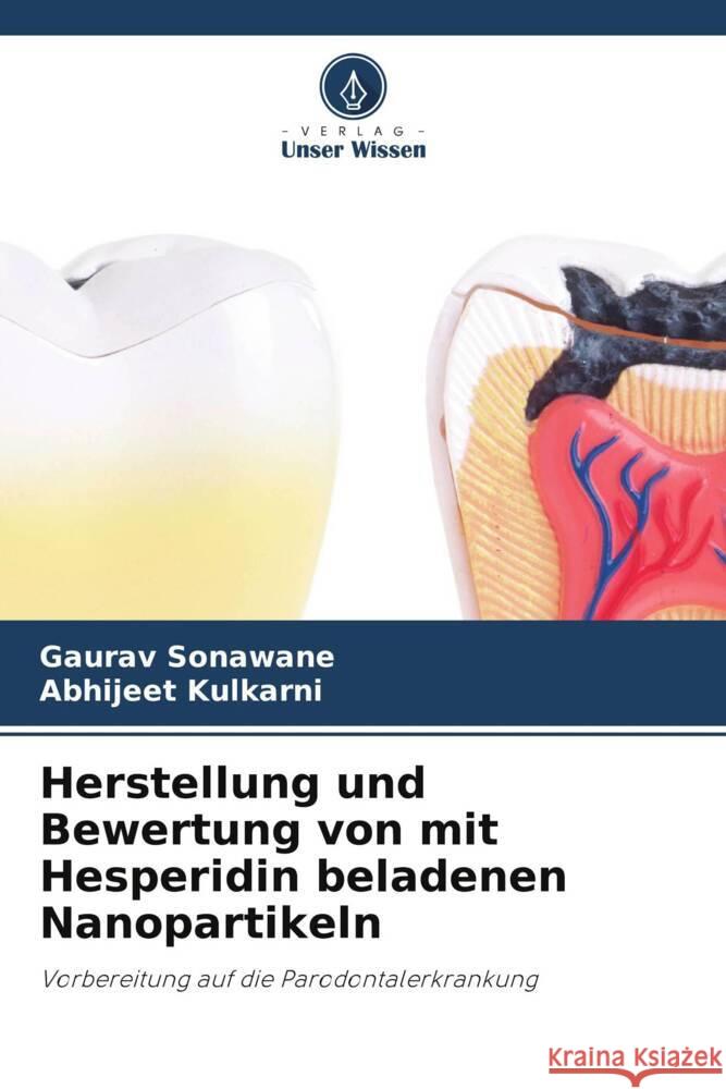 Herstellung und Bewertung von mit Hesperidin beladenen Nanopartikeln Sonawane, Gaurav, Kulkarni, Abhijeet 9786205596586