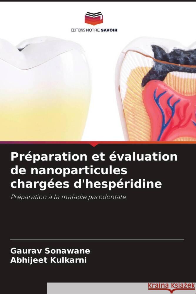 Préparation et évaluation de nanoparticules chargées d'hespéridine Sonawane, Gaurav, Kulkarni, Abhijeet 9786205596609