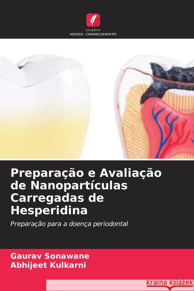 Preparação e Avaliação de Nanopartículas Carregadas de Hesperidina Sonawane, Gaurav, Kulkarni, Abhijeet 9786205596623