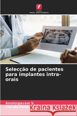 Selec??o de pacientes para implantes intra-orais Amalorpavam V Claudia Peter 9786205600092