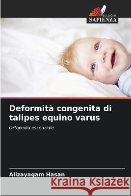 Deformit? congenita di talipes equino varus Alizayagam Hasan 9786205606698