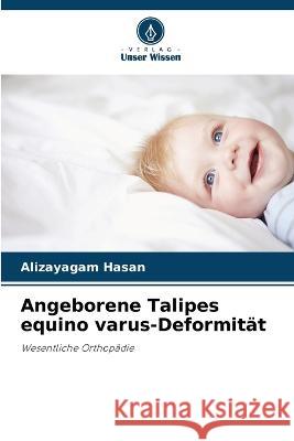 Angeborene Talipes equino varus-Deformit?t Alizayagam Hasan 9786205606858