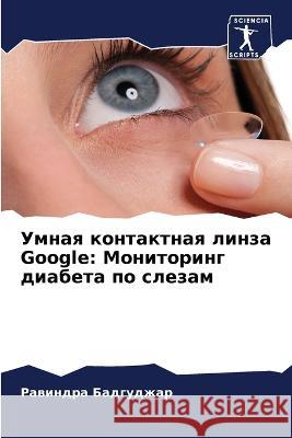 Умная контактная линза Google: Бадгуk 9786205608579 Sciencia Scripts