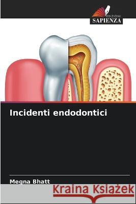 Incidenti endodontici Megna Bhatt   9786205613030