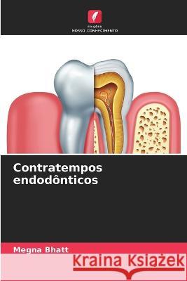 Contratempos endodonticos Megna Bhatt   9786205613047