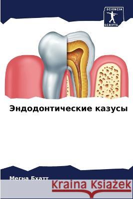 Jendodonticheskie kazusy Bhatt, Megna 9786205613054 Sciencia Scripts