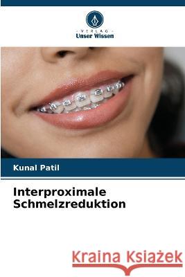 Interproximale Schmelzreduktion Kunal Patil 9786205614297 Verlag Unser Wissen