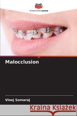 Malocclusion Vinej Somaraj   9786205626535