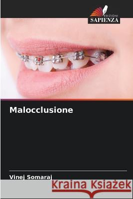 Malocclusione Vinej Somaraj   9786205626542