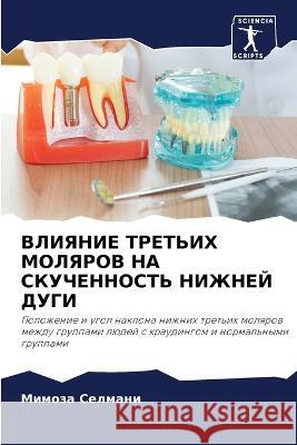 ВЛИЯНИЕ ТРЕТЬИХ МОЛЯРОВ Селмаl 9786205629727 Sciencia Scripts