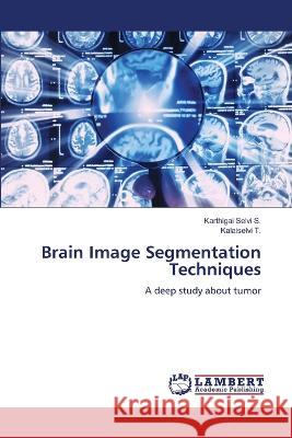 Brain Image Segmentation Techniques Karthigai Selvi S Kalaiselvi T 9786205633830 LAP Lambert Academic Publishing