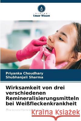 Wirksamkeit von drei verschiedenen Remineralisierungsmitteln bei Weissfleckenkrankheit Priyanka Choudhary Shubhanjali Sharma  9786205645086