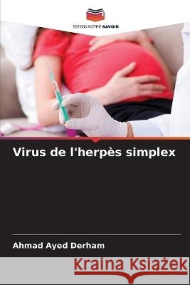 Virus de l\'herp?s simplex Ahmad Ayed Derham 9786205647301