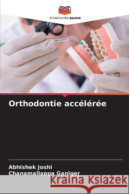 Orthodontie acc?l?r?e Abhishek Joshi Chanamallappa Ganiger 9786205653852 Editions Notre Savoir