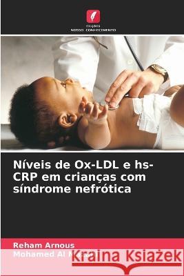 Niveis de Ox-LDL e hs-CRP em criancas com sindrome nefrotica Reham Arnous Mohamed Al Mazahi  9786205658727 Edicoes Nosso Conhecimento