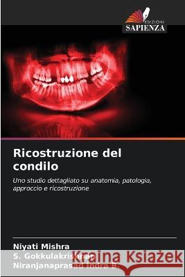 Ricostruzione del condilo Niyati Mishra S. Gokkulakrishnan Niranjanaprasad Indr 9786205661901 Edizioni Sapienza