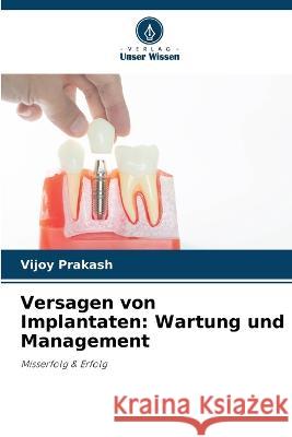 Versagen von Implantaten: Wartung und Management Vijoy Prakash   9786205662281