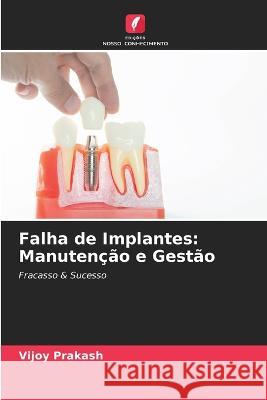 Falha de Implantes: Manuten??o e Gest?o Vijoy Prakash 9786205662328 Edicoes Nosso Conhecimento