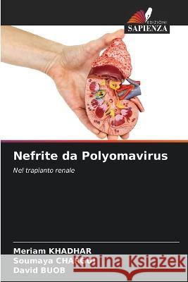 Nefrite da Polyomavirus Meriam Khadhar Soumaya Chargui David Buob 9786205665633