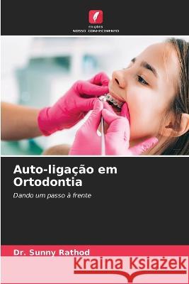 Auto-liga??o em Ortodontia Sunny Rathod 9786205674031 Edicoes Nosso Conhecimento