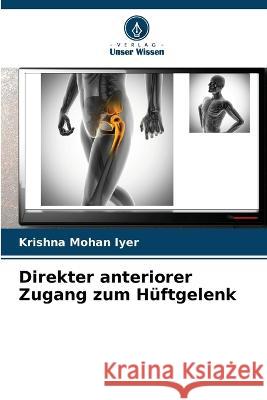 Direkter anteriorer Zugang zum H?ftgelenk Krishna Mohan Iyer 9786205678947