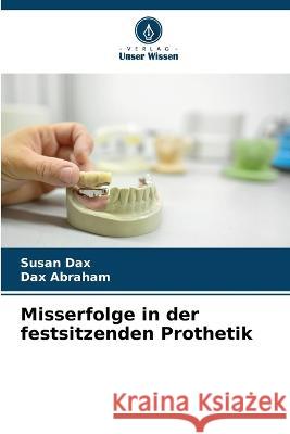 Misserfolge in der festsitzenden Prothetik Susan Dax Dax Abraham 9786205679784 Verlag Unser Wissen