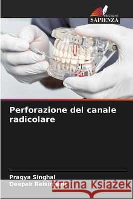 Perforazione del canale radicolare Pragya Singhal Deepak Raisingani 9786205688700