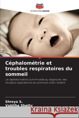 C?phalom?trie et troubles respiratoires du sommeil Shreya S Vabitha Shetty 9786205689943 Editions Notre Savoir