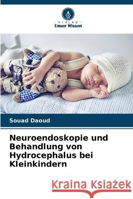 Neuroendoskopie und Behandlung von Hydrocephalus bei Kleinkindern Souad Daoud 9786205704752 Verlag Unser Wissen