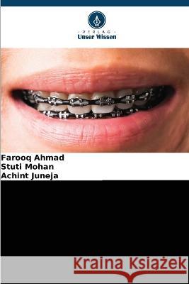 Biologie und Biomarker der beschleunigten kieferorthop?dischen Zahnbewegung Farooq Ahmad Stuti Mohan Achint Juneja 9786205706671