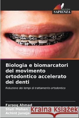 Biologia e biomarcatori del movimento ortodontico accelerato dei denti Farooq Ahmad Stuti Mohan Achint Juneja 9786205706695
