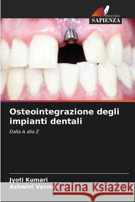 Osteointegrazione degli impianti dentali Jyoti Kumari Ashwini Verma 9786205712504