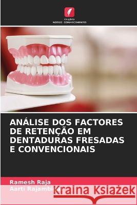 An?lise DOS Factores de Reten??o Em Dentaduras Fresadas E Convencionais Ramesh Raja Aarti Rajambigai 9786205719374