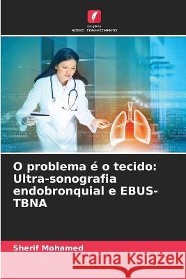 O problema ? o tecido: Ultra-sonografia endobronquial e EBUS-TBNA Sherif Mohamed 9786205725719