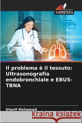 Il problema ? il tessuto: Ultrasonografia endobronchiale e EBUS-TBNA Sherif Mohamed 9786205725726 Edizioni Sapienza