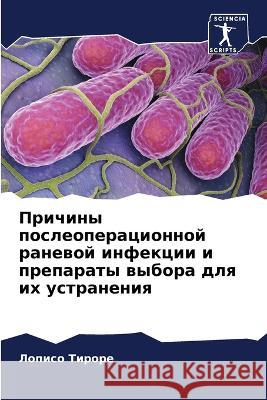 Причины послеоперацион&# Тирорk 9786205726167 Sciencia Scripts