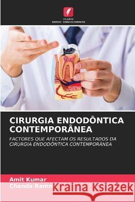 Cirurgia Endod?ntica Contempor?nea Amit Kumar Chanda Ramni 9786205727898 Edicoes Nosso Conhecimento