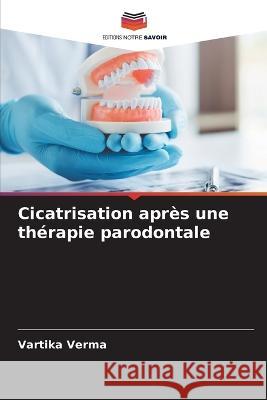 Cicatrisation apres une therapie parodontale Vartika Verma   9786205728550